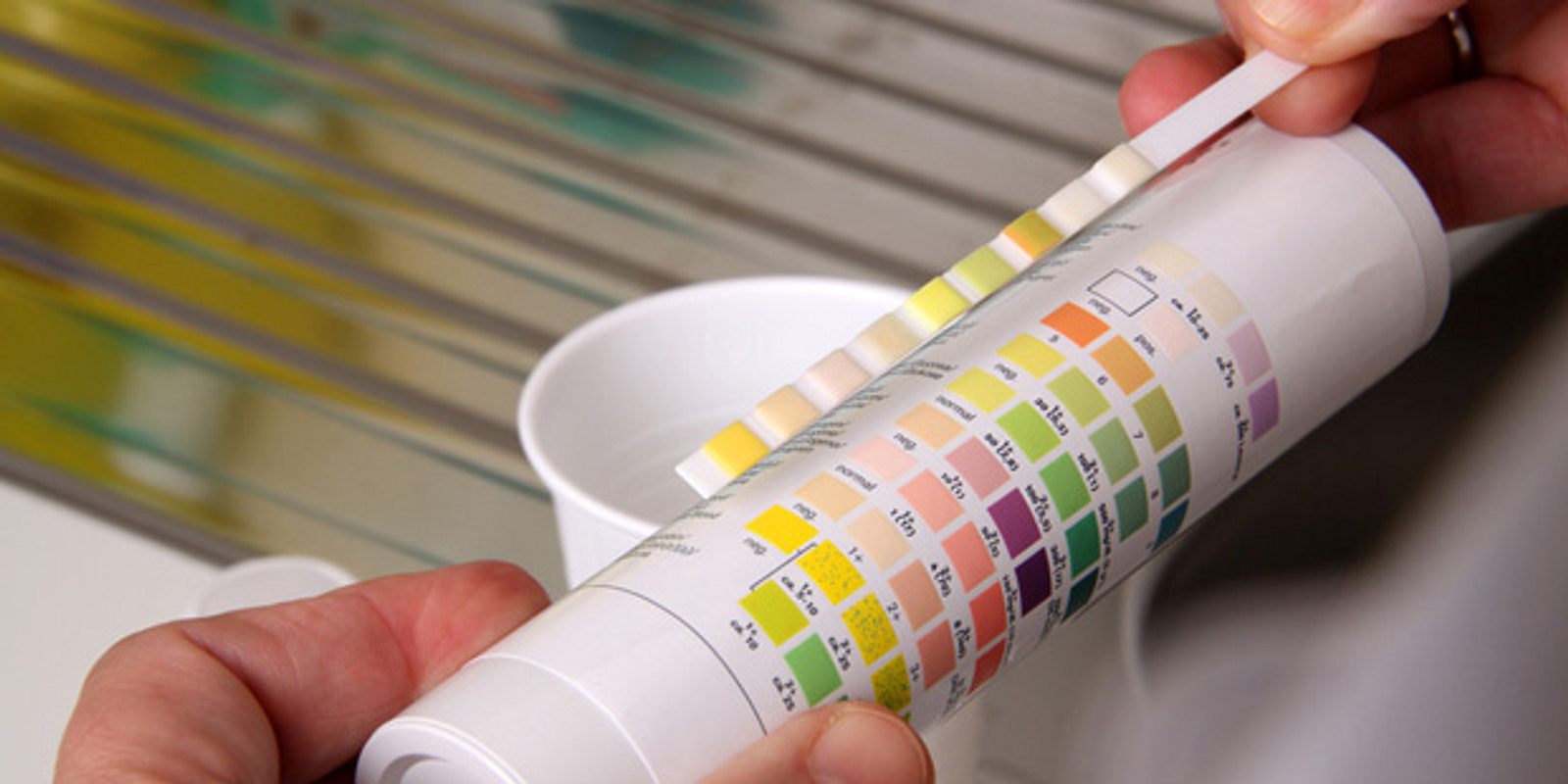 Исследование мочи на сахар. Тест мочи на соли. Экспресс тест на наркологические вещества. Тест на наркологические вещества. Уриглюк-1.