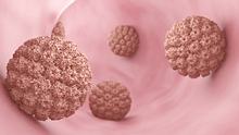 Feigwarzen: Ursachen sind Humane Papillomviren (HPV) - Foto: iStock / luismmolina 