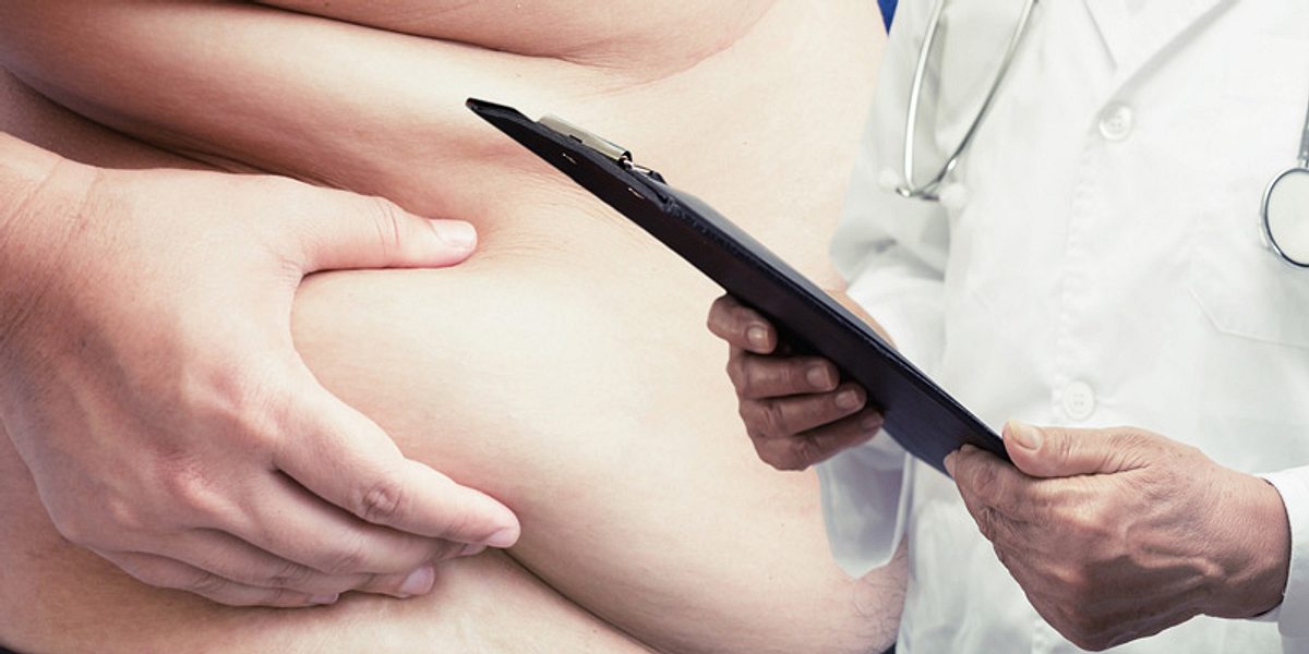 Fettleibiger mit Arzt
