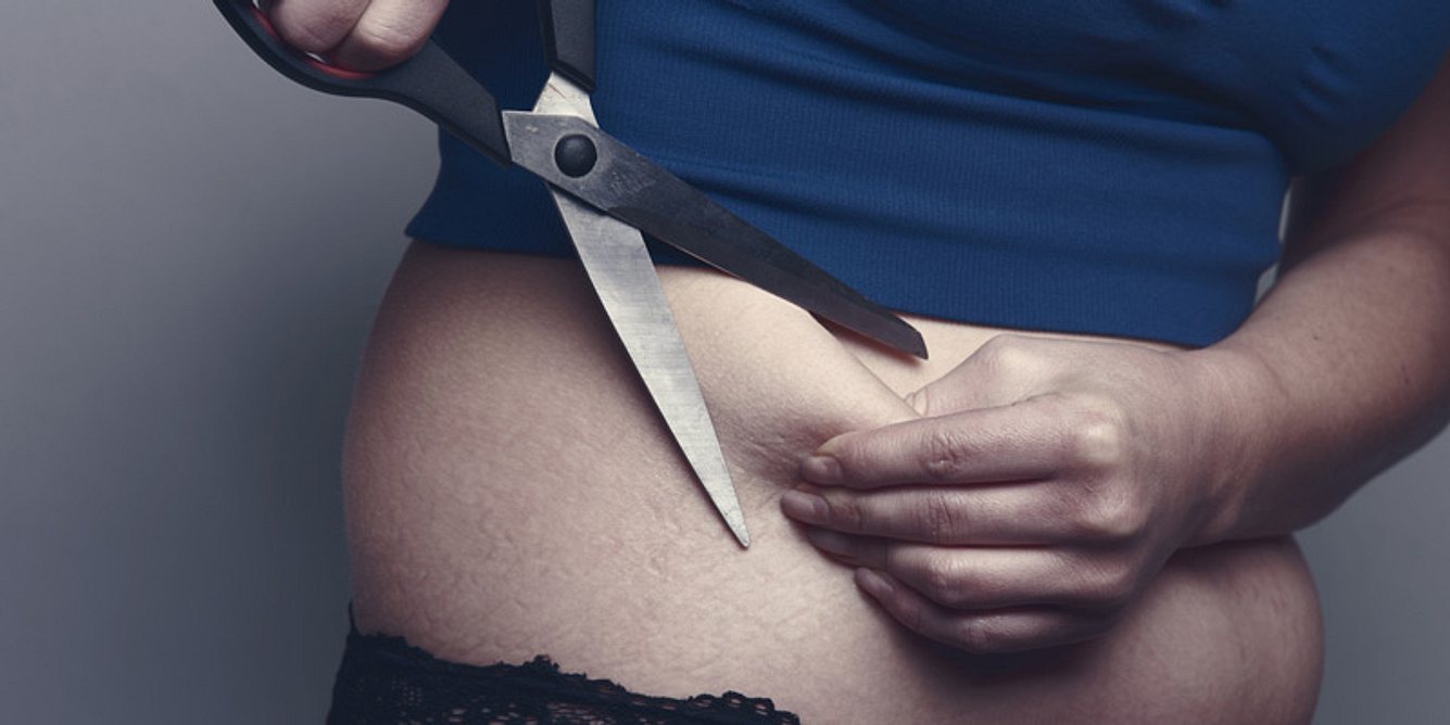 Frau will Fett am Bauch abschneiden