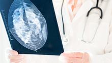 Eine Ärztin hält einen Mammographie Scan  - Foto: iStock / Natalia Sokhrannova