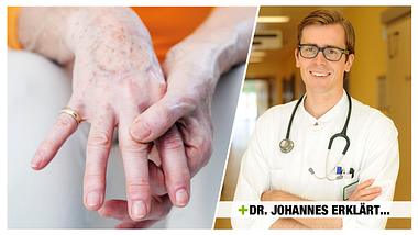 Schmerzen in den Fingergelenken - Foto: alamy/dr.johannes