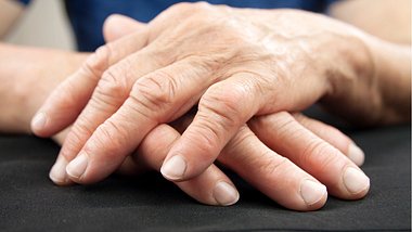 Eine Frau mit Fingerathrose zeigt ihre Hände. - Foto: iStock/Suze777