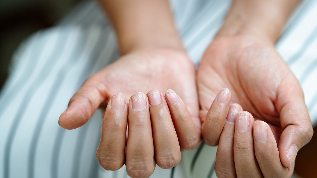 Hände mit gepflegten Fingernägeln - Foto: iStock/PORNCHAI SODA