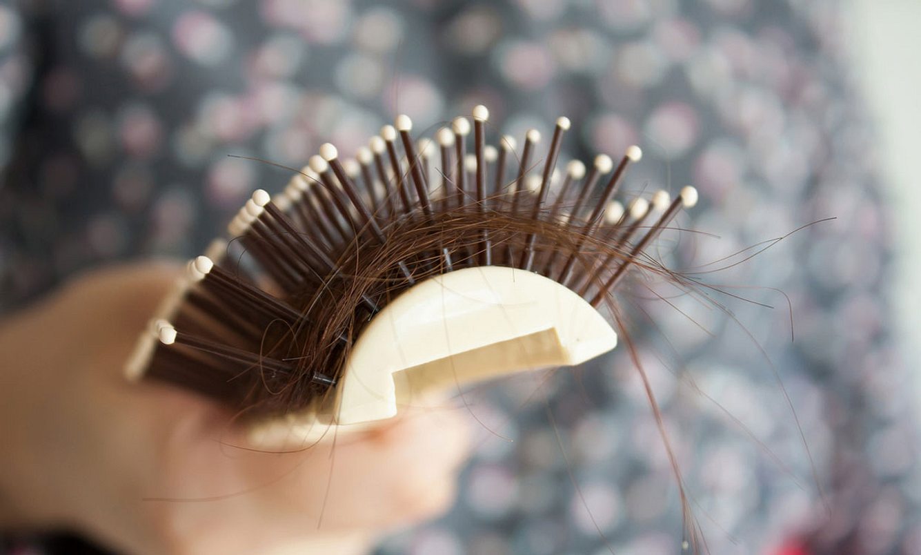 Frau hält Bürste mit vielen ausgefallenen Haaren in der Hand