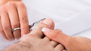 Frau schneidet Mann die Fußnägel gegen eingewachsene Fußnägel - Foto: iStock/AndreyPopov