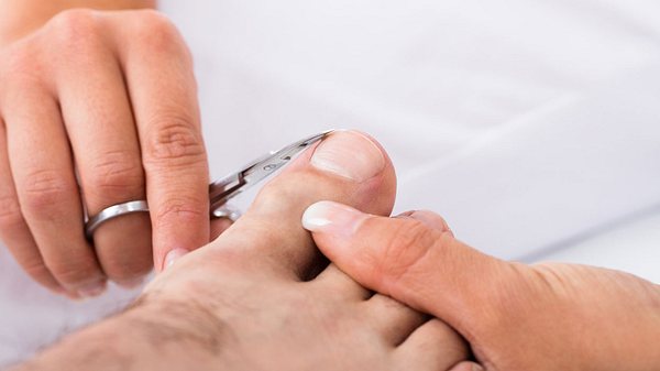 Frau schneidet Mann die Fußnägel gegen eingewachsene Fußnägel - Foto: iStock/AndreyPopov