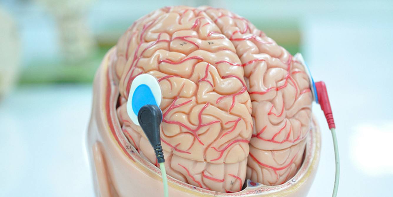 EEG