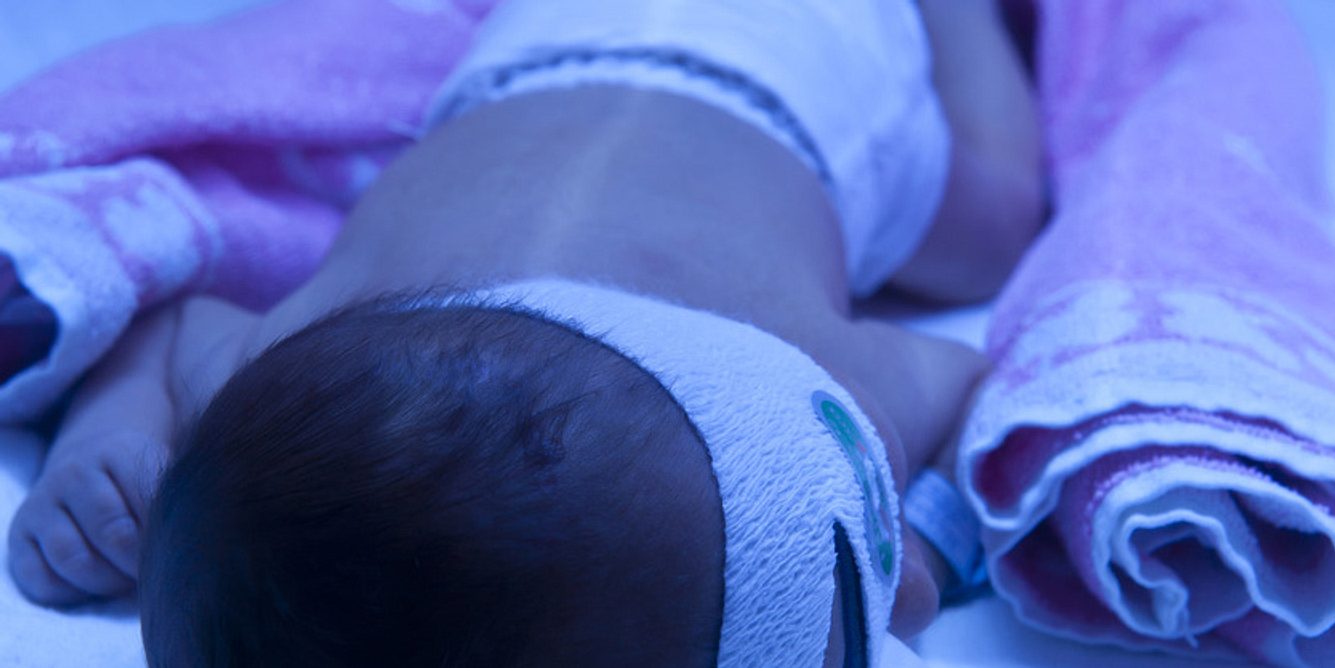 Bei einer Neugeborenen-Gelbsucht wird der Säugling mit der sogenannten Phototherapie behandelt