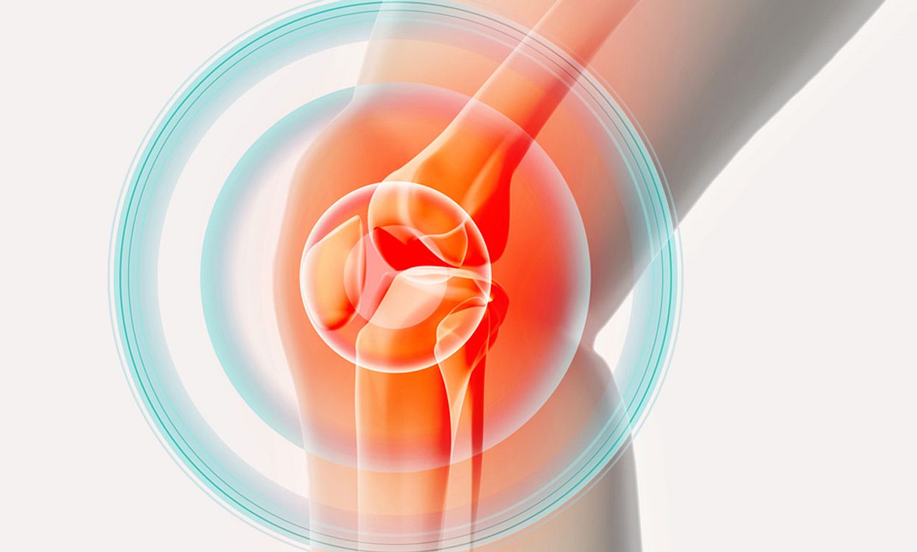 Gelenkschmerzen im Knie
