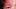 Gesichtsrose beim Kind - Foto: alamy