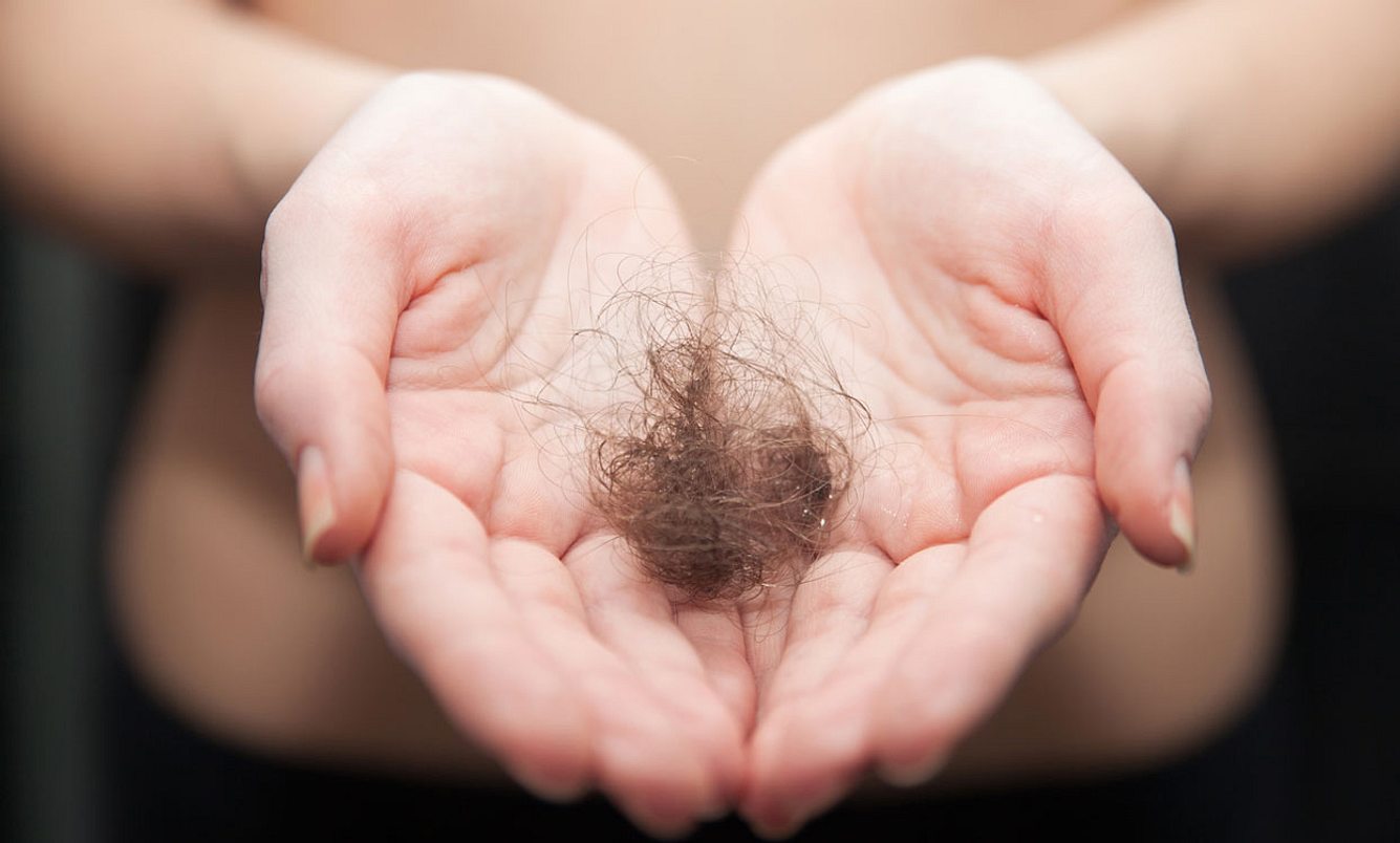 Haarausfall Frauen