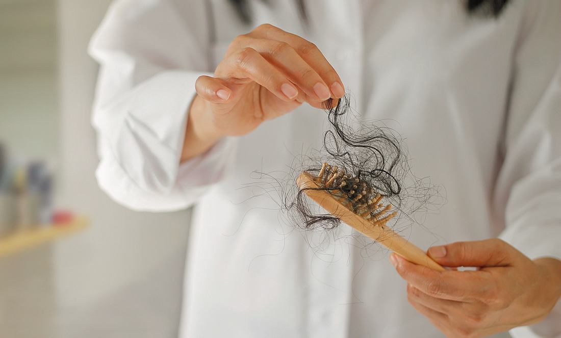 Haarausfall-Symptome: Plötzlicher starker Haarverlust