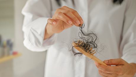 Haarausfall-Symptome: Plötzlicher starker Haarverlust - Foto: iStock / ipopba