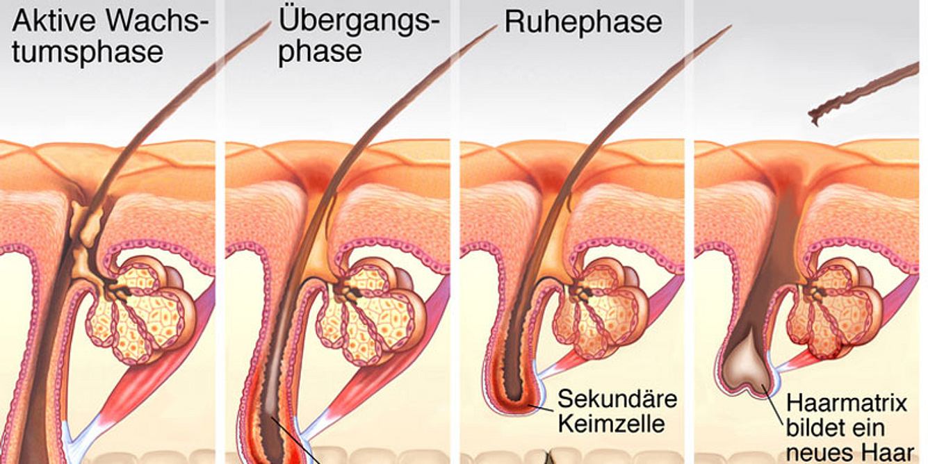 Haarausfall