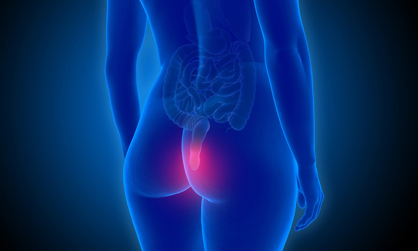 Frau mit Hämorrhoiden