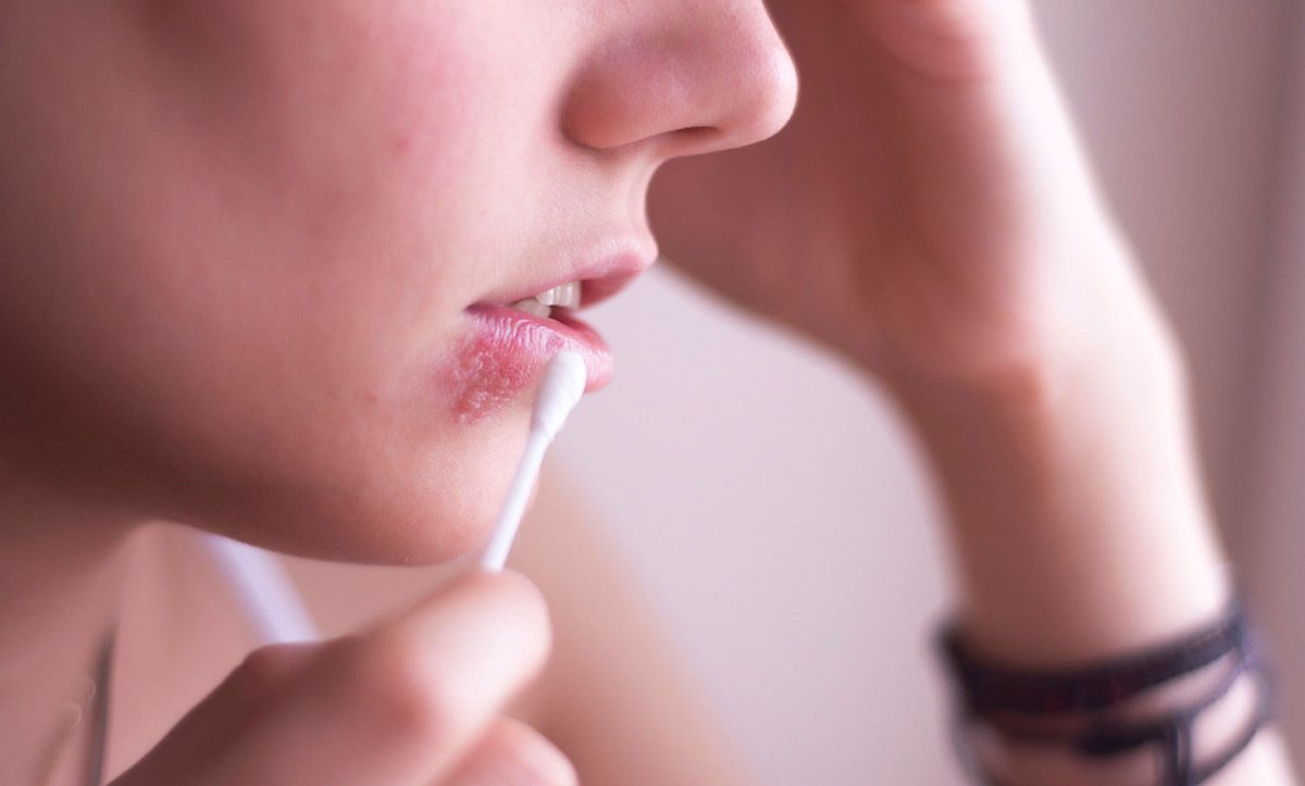 Frau tupft sich mit Wattestäbchen an der Lippe