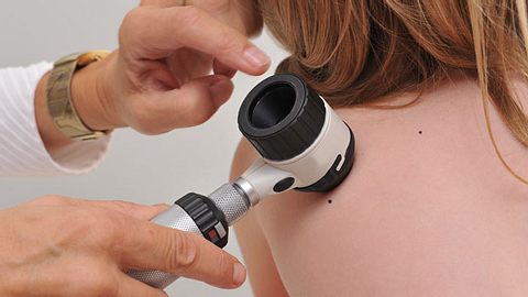 Hautarzt untersucht Kind auf Hautveränderungen - Foto: Shutterstock