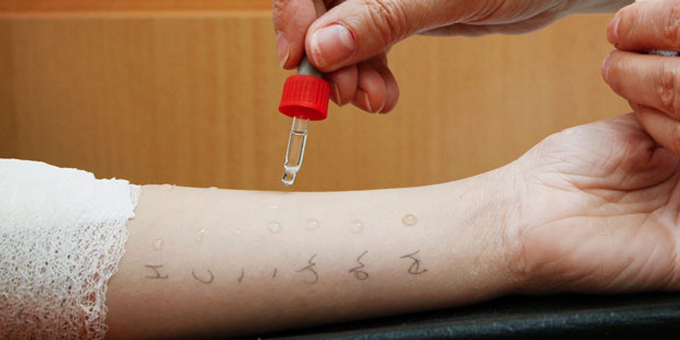 Prick-Test auf Unterarm