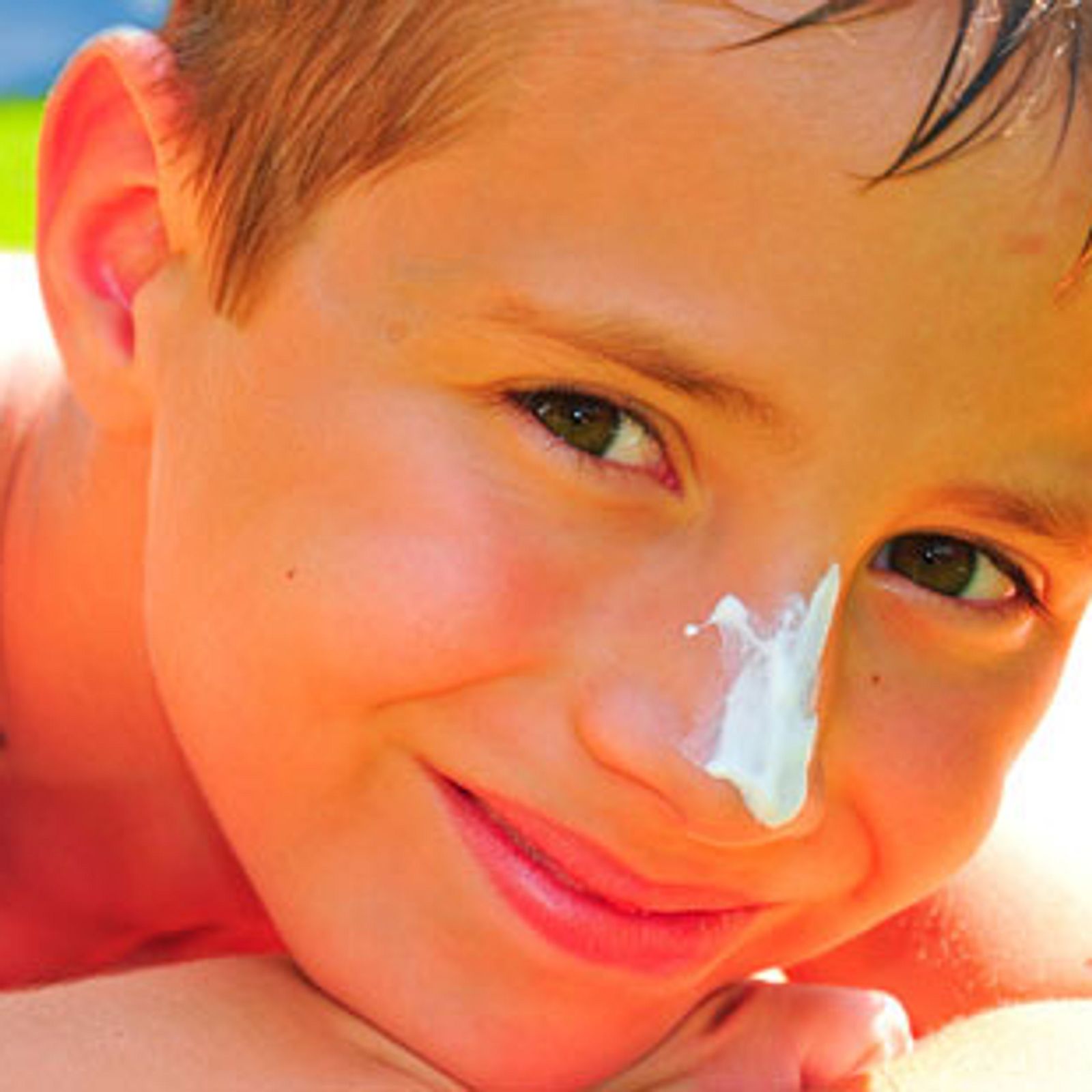 Sonnenbrand bei Kindern – Hautkrebs-Risiko steigt