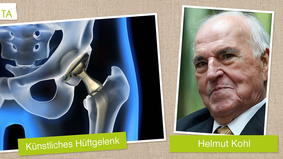 Altkanzler Helmut Kohl hat anscheinend ein neues Hüftgelenk bekommen - Foto: Fotolia