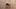 Großaufnahme einer Hirschlausfliege auf menschlicher Haut mit Haaren - Foto: istock/Henrik_L