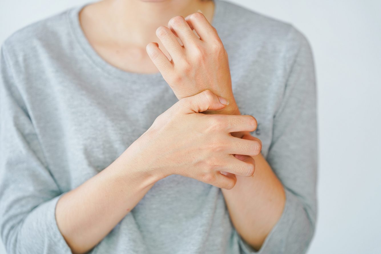 homoeopathie-bei-neurodermitis-sanfte-therapie-heilte-meine-haut Frau mit Neurodermitis kratzt sich am Arm