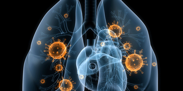 Husten oder Atemnot können Alarmsignale für ernsthafte Lungenerkranungen sein – wie z.B. eine Lungenentzündung