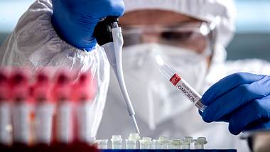 Laborabtin in Schutzkleidung mit Pipette und Röhrchen - Foto: IMAGO / Pixsell