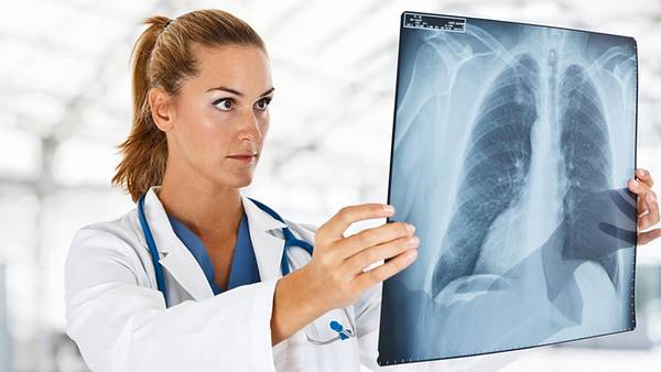 Ärztin prüft Aufnahme der Lunge - Foto: Fotolia
