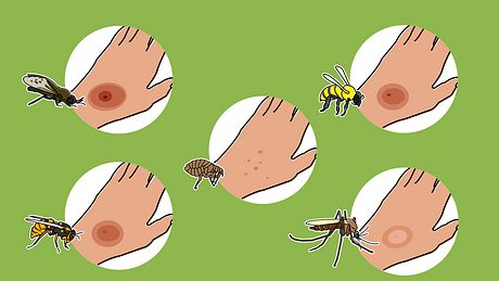Grafik verschiedener Insektenstiche - Foto: PraxisVITA/Vivian Mule