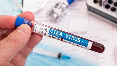 Person hält Blutprobe mit Zika-Virus in der Hand - Foto: Istock/membio