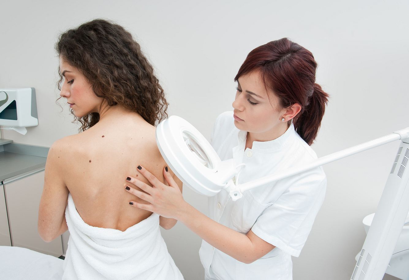 Ab 35 Jahren haben gesetzlich Krankenversicherte Anspruch auf die Früherkennungsuntersuchung auf Hautkrebs