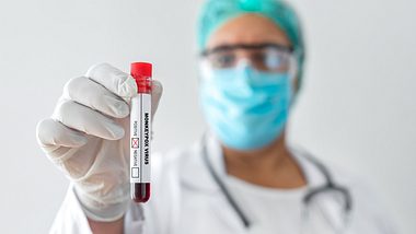 Laborant hält Röhrchen mit Blut - Foto: iStock/bymuratdeniz