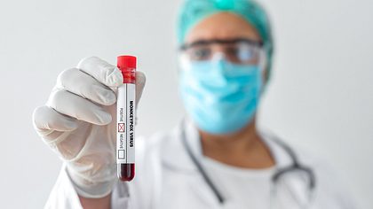 Laborant hält Röhrchen mit Blut - Foto: iStock/bymuratdeniz