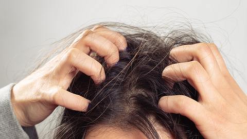 Eine Frau kratzt sich an der Kopfhaut - Foto: iStock_Mikhail Azarov