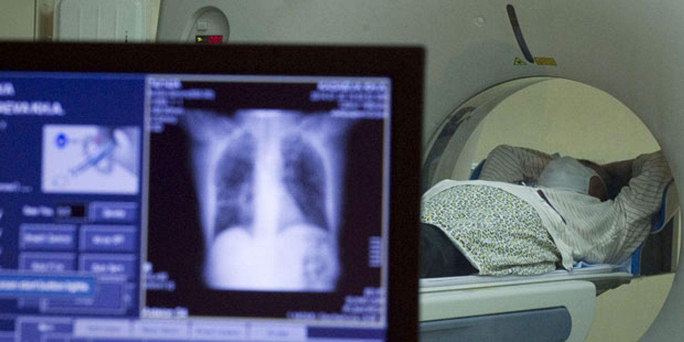 Eine Kernspintomografie verrät, ob sich der Herzmuskel entzündet hat