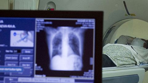 Eine Kernspintomografie verrät, ob sich der Herzmuskel entzündet hat - Foto: Corbis