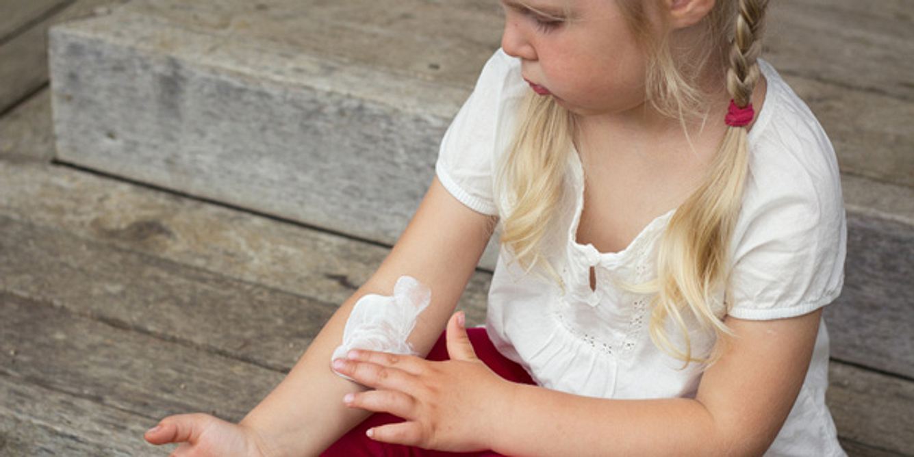 Kind mit Röschenflechte trägt Salbe zur Juckreiz Behandlung auf