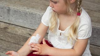 Kind mit Röschenflechte trägt Salbe zur Juckreiz Behandlung auf - Foto: Fotolia