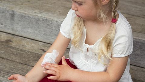 Kind mit Röschenflechte trägt Salbe zur Juckreiz Behandlung auf - Foto: Fotolia