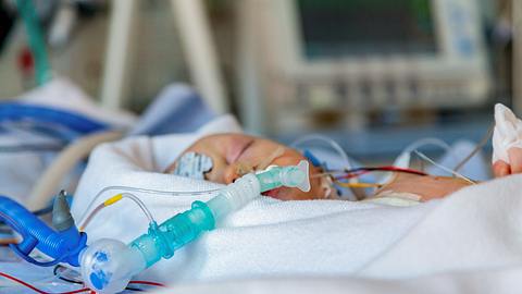 Ein Baby liegt auf der Intensivstation - Foto: iStock/Perboge