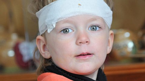 Kind mit Kopfverband - Foto: Fotolia