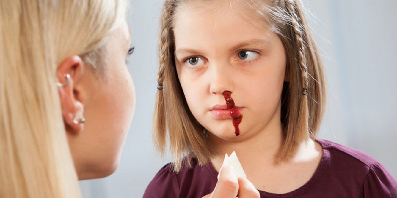 Eine blutende Nase beim Kind wird versorgt