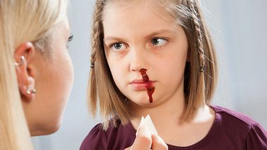 Eine blutende Nase beim Kind wird versorgt - Foto: Fotolia