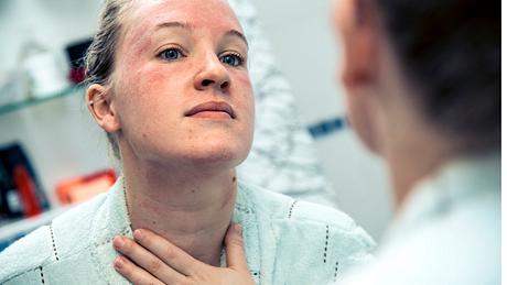 Bei einer Kontaktallergie reagiert der Körper mit Irritationen der Haut - Foto: iStock/AzmanL