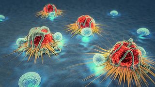 Grafische Darstellung von Krebszellen. - Foto: iStock/Christoph Burgstedt