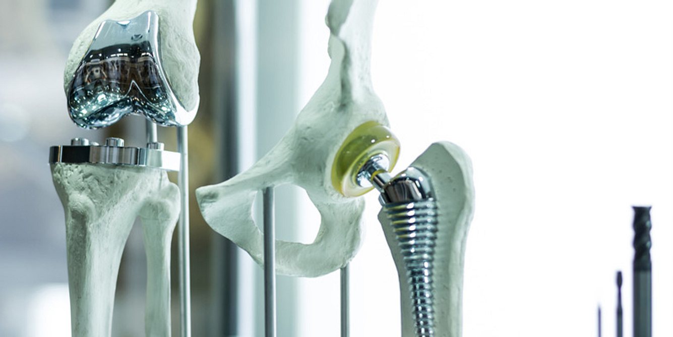Künstliches Knie- und Hüftgelenk