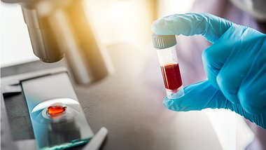 Ein Laborassistent hält eine Blutprobe in der Hand - Foto: iStock/Totojang