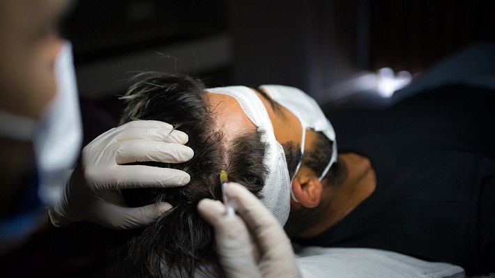 Mann wird am Kopf untersucht - Foto: istock/byakkaya